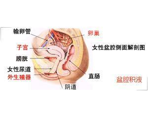 青春期盆腔积液详解，成因、影响及防治策略