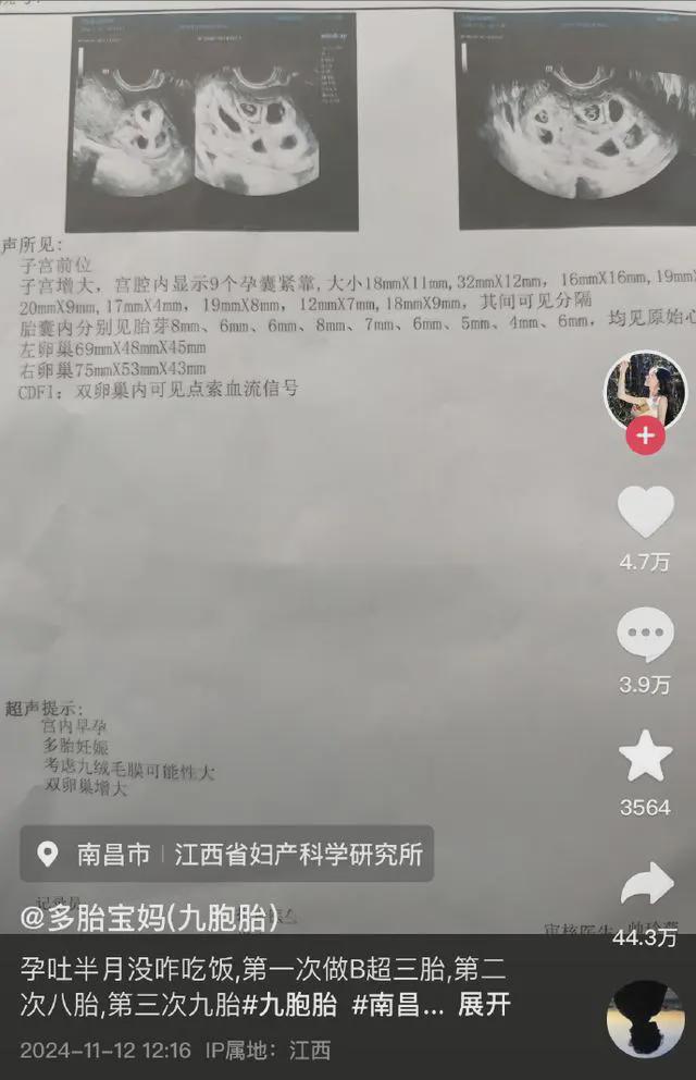 九胞胎最新成长动态，瞩目中的奇迹与成长之路